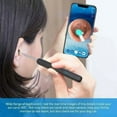 thumbnail image 1 of Wi -Fi visible wax elimination spoon, USB 1080P HD load otoscope, 1 of 1