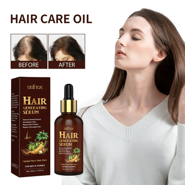 Salud y belleza, Cuidado personal, Productos para el cuidado del cabello, Aceite de menta fortalecedor para el cuero cabelludo y el cabello con biotina, nutritivo para puntas abiertas y cuero cabellud