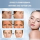 thumbnail image 5 of Mascarilla de Colágeno Bio para Mujeres y Adolescentes Reafirmante que Minimiza Poros y Mejora Elast, 5 of 7