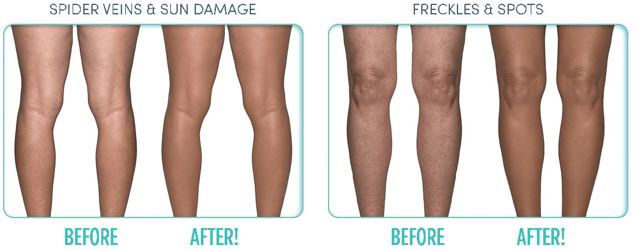 Ideal Conceal Light to Medium Instant Body Enhancer As Seen On Tv