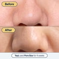 thumbnail image 4 of Minimizador de poros Remedy Science con retinol y ácido salicílico BHA, 4 of 8