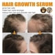 thumbnail image 3 of Spray nutritivo para el crecimiento del cabello Yashi 1-3 piezas con biotina, 3 of 5