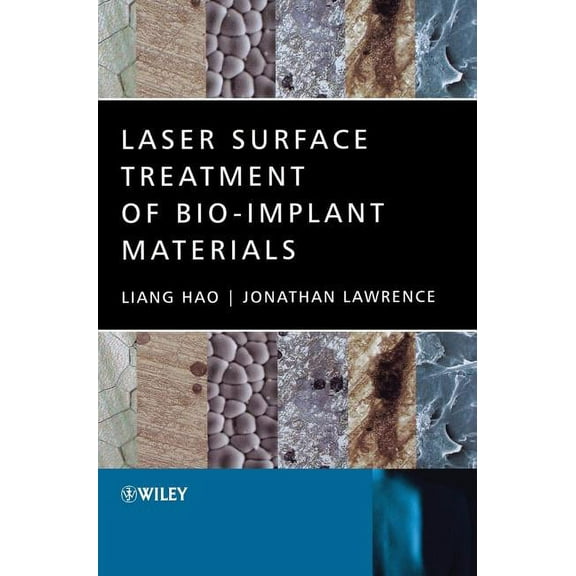 Laser Surface Treatment of Bio-Implant Materials, (Hardcover)