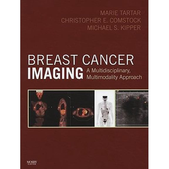 Pre-Owned Breast Cancer Imaging: A Multidisciplinary, Multimodality Approach (Hardcover) 0323046770 9780323046770