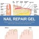 thumbnail image 5 of 3pcs Anti-Fungal Nail Treatment Gel Nail Care Gel Nail Thickening Brightening Onychomycosis Repair Cream, 5 of 5