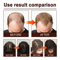thumbnail image 4 of Rosemary Rice Water Spray, Thicken Hair Rice Water Spray for Hair 60ml Fine Mist  for Damaged Hair, 4 of 8