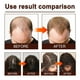 thumbnail image 3 of Suero Para El Cabello Con Agua De Arroz, 60 Ml, 2 Piezas, Spray De Agua De Arroz Con Aceite De Romero, Reduce La Caspa, Espesa El Equilibrio Del Cabello, Aceite, Agua, Niebla Fina,, 3 of 7