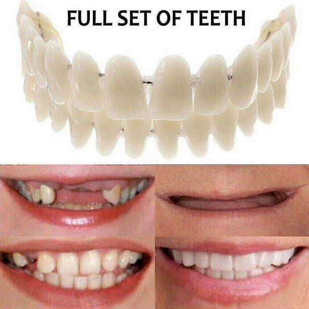 Upper Lower Dental Veneers Dentures - Snap On False Teeth For A Perfect Smile