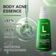 thumbnail image 3 of Jaysuing Anti-Acne Whitening Essence Fades Acne Spots and Marks Moisturizing Whitening Skin Care Essence BF, 3 of 5