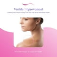 thumbnail image 3 of Derminish Scar Wipes - Acne & Scar Remover, Stretch Mark Pads - 50 Pads, 3 of 11