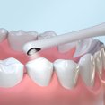 thumbnail image 4 of Timesiso Intelligent Oral Visual Dental Mirror Endoscope T5-YPC Take Pictures, 4 of 8