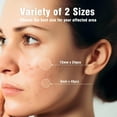 thumbnail image 2 of OUKEYA Hydro Clear Patches for Sensitive Skin Overnight Treatment 36 Pcs, 2 of 8