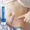 thumbnail image 2 of NewKeloid crema de eliminación rápida de cicatrices, tratamiento de estrías, quemaduras, hiperplasia quirúrgica, cicatrices, acné, reparación de manchas, blanquea la piel suave, 2 of 5