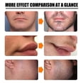 thumbnail image 5 of 2pcs Men Beard Growth Roller SetMen's Beard Growth Essence Nourishing Enhancer Beard Oil Spray Beard Care, 5 of 5