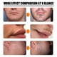 thumbnail image 5 of 2pcs Men Beard Growth Roller SetMen's Beard Growth Essence Nourishing Enhancer Beard Oil Spray Beard Care, 5 of 5