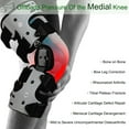 thumbnail image 2 of Rodillera Orthomen OA Unloader para aliviar el dolor de la artritis, 2 of 9