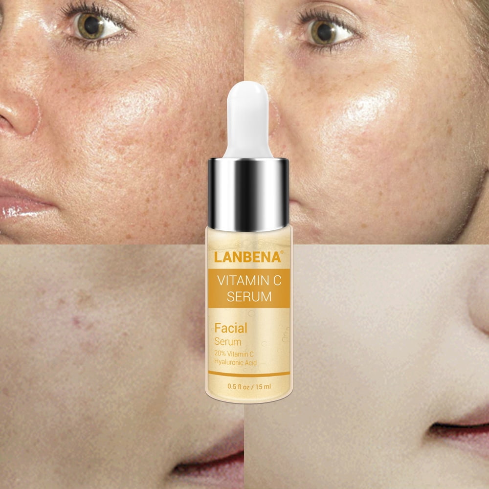 Vitamin C Serum for Face with Hyaluronic Acid & Witch Hazel - Radiant Skin - Dark Spots Anti Aging Freckle Removal Moisturizing Essence 15ml (0.5 fl oz)