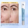 thumbnail image 2 of Sérum para ojos XYJIAXI efecto reafirmante instantáneo antiedad 15 ml, 2 of 8