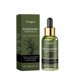 thumbnail image 1 of Aceite de romero para el crecimiento del cabello con árbol de té y coco, sérum nutritivo para el cuero cabelludo 60 ml, 1 of 5