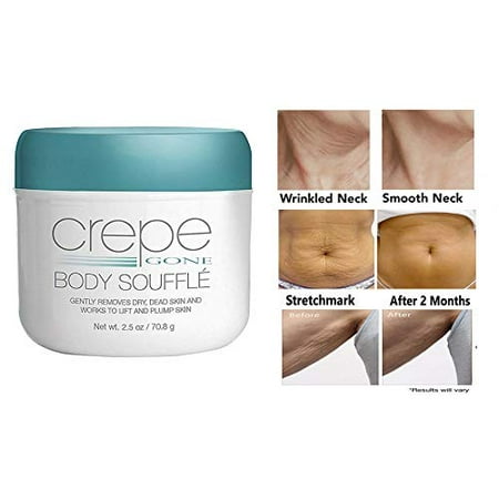 Crepe Gone Away Cream Body Souffle Helps Smooth, Plump, And Firm Dry, Aging Skin Pharmacist Created and Recommended