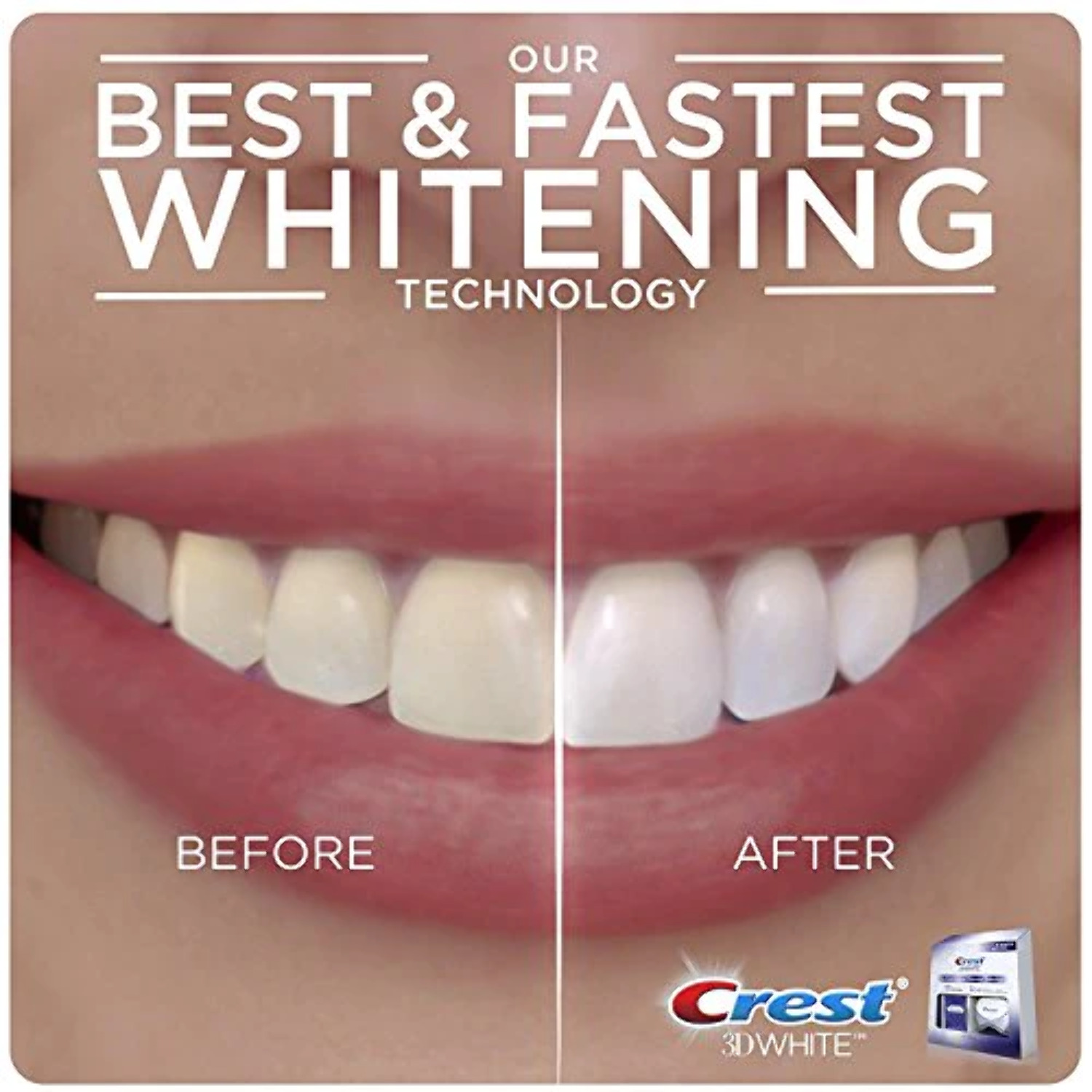 Crest 3D Whitestrips with Light Teeth Whitening Strip Kit, 10 Treatments - image 3 of 4
