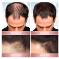 thumbnail image 4 of Hair Helper Spray - Hair Helper Spray For Thinning Hair, Rice Water Spray, 4 of 5
