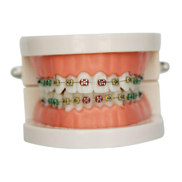 Tachiuwa Sumulation Teeth Model with Metal Braces for Student Kids Teaching Classroom