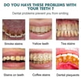 thumbnail image 4 of Teeth Whitening Gel, Tooth Polish, Instant Whitening Paint For Teeth, Safe And Effective For Se, 4 of 5