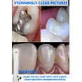 thumbnail image 5 of DARYOU DY-50 Intraoral Camera Dental Camera Super Clear Button Driver Included Work W/Eaglesoft Dexis More, 5 of 5