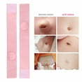 thumbnail image 3 of Duslogis 2pcs Umbilical Hernia Belt for Babies,Hernia Patch,Belly Button Hernia Belt,Infant Abdominal Navel Support Newborn Belly Belt,Adjustable Newborn Belly Support Band Wrap, 3 of 7