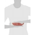 thumbnail image 7 of Outset Pub Food Baskets, Set of 6, Red, 9.5" x 6.25" x 2", 7 of 7