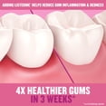 thumbnail image 4 of Enjuague bucal Listerine Gum Therapy, antiplaca, paquete doble de 1 litro, 4 of 7