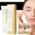 thumbnail image 2 of Xihbxyly Crema para Ojos, Fórmula para Aliviar Ojeras, Tratamiento Reparador Reafirmante, Solución Hidratante Iluminadora, Cuidado Antiedad, Rutina Diaria para El Cuidado de Los Ojos, Crema Ligera de, 2 of 7