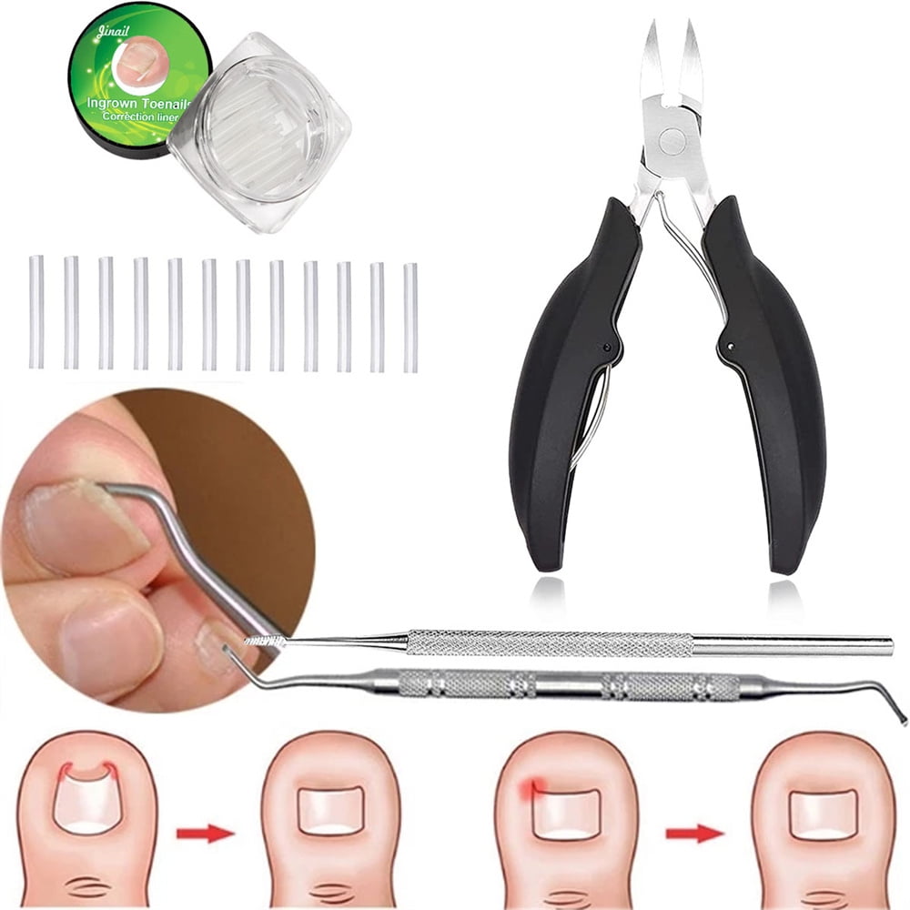 53Pieces Toenail Corrector, Ingrown Toenail Tool Set, Toenail Patch