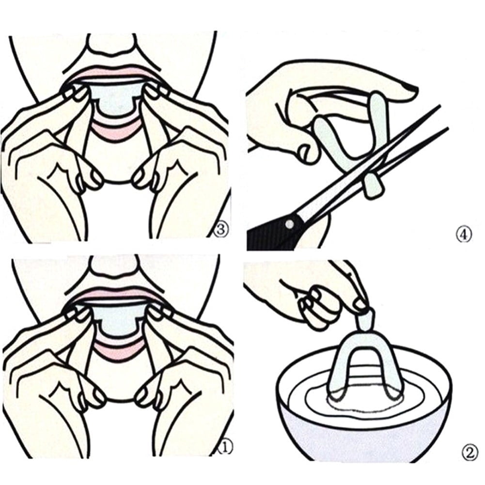 4pcs Night Mouth Guard Gum Shield for Bruxism Teeth Protector Whitening Grinding Bites Brace