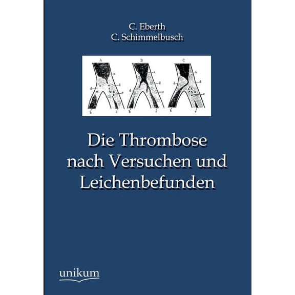 Die Thrombose Nach Versuchen Und Leichenbefunden (Paperback)