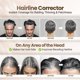 thumbnail image 3 of Koloret Root Touch Up Powder– Gray Powder for Women & Men, Instant Root Cover Up for Gray Coverage, Hairline Concealer for Thinning Hair & Bald Spots, Water-Resistant & Smudge-Proof, 10g, 3 of 5