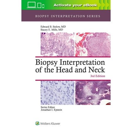 UPC: 9781975139360 | Biopsy Interpretation: Biopsy Interpretation of the Head and Neck (Hardcover)