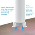 thumbnail image 3 of Suction Tool Vacuum Extractor for Skin and Itch Reduction Kid Friendly Design, 3 of 4