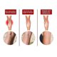 thumbnail image 2 of Varicose Care Patch Leg Massage Relieve Soreness Earthworm Leg Vein Care Patch Massage O, 2 of 4
