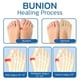 thumbnail image 4 of Calcetines de compresión Qauxbul Sockalign Bunion para mujer, 5 pares, 4 of 6