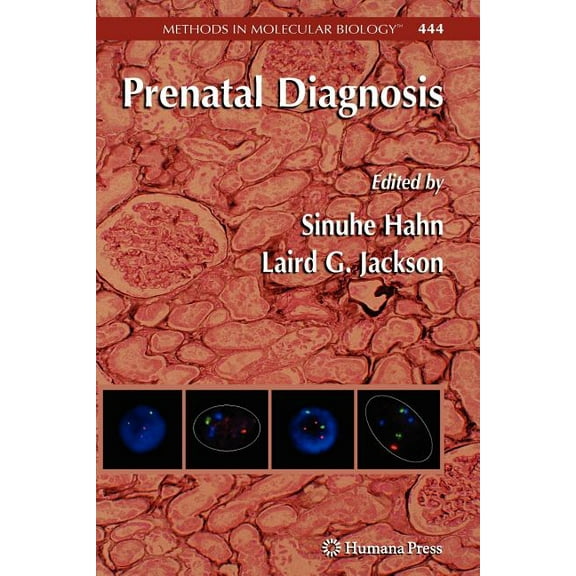 Methods in Molecular Biology Prenatal Diagnosis, Book 444, (Paperback)