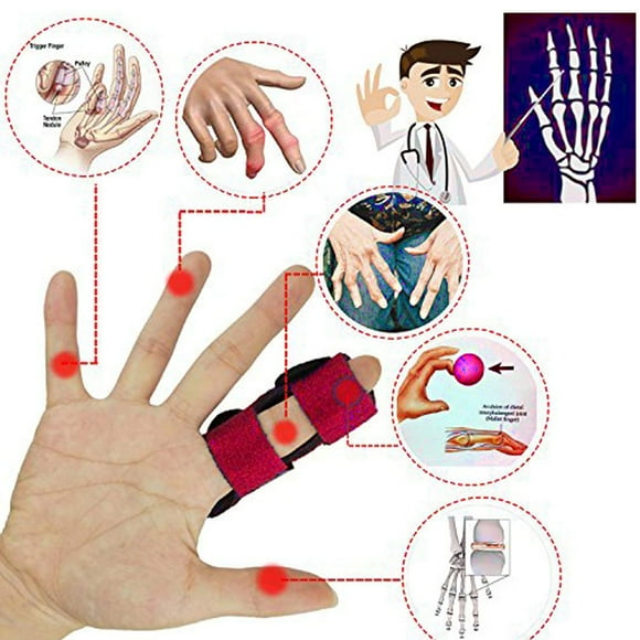 Trigger Finger Splints Finger Splint Trigger Finger Mallet Finger Splints Adjustable Finger Support Brace With Aluminium Support For Finger Joint Pain