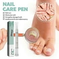 thumbnail image 4 of nail fungus remover pen for quick repair, 4 of 5