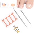 thumbnail image 4 of Corrector de uñas encarnadas de acero inoxidable recogedor de uñas de los pies juego de herramientas de corrección de pegatinas para los dedos del pie ANGGREK Otros, 4 of 8