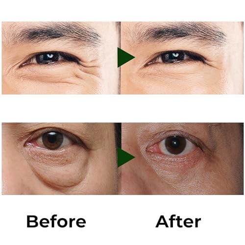 ABERA Eye Roller Serum for Men, For the Look of Dark Circles and Puffiness, Mint Essence with Vitamin C and Peptides, 0.34 fl oz