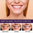thumbnail image 2 of EELHOE Tooth Beautifying Agent Yellow and Stain Removal, Pigment Precipitation Prevention, Cleaning and Brighteni, 2 of 5
