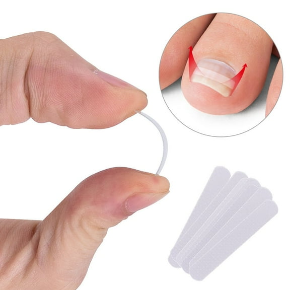 Ingrown Toenail Corrector Strips,Curved Brace Toenails Correction Tool,Ingrown Toenail Pedicure Tool,Curved Brace Toenails Thick Paronychia Correction Tool. Transparent,12 Pieces