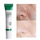 thumbnail image 2 of Crema de ácido salicílico 20ml Eliminación de poros/acné y blanqueamiento/brillo/blanqueamiento/anti-manti/Control de aceite, 2 of 3