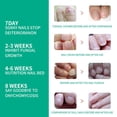 thumbnail image 2 of 30ml Toenail Fungus Oil Nail Care Repair Liquid para blanqueamiento antihongos Ndcxsfigh  Cuidado Belleza, 2 of 6